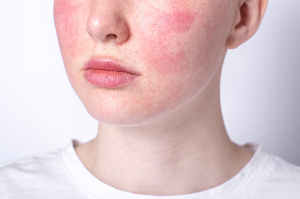 Understanding and Caring for Sensitive Skin: A Complete Guide