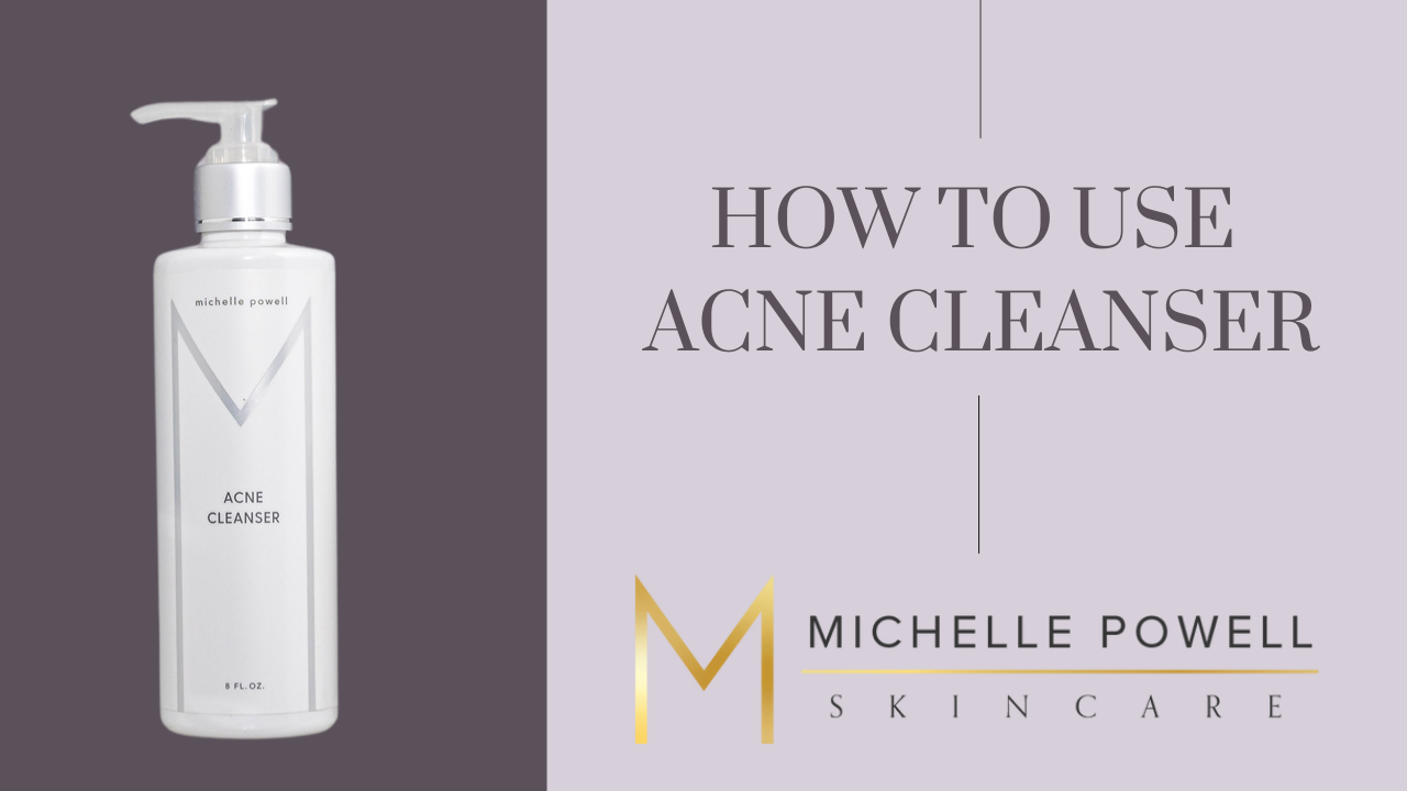 Acne Cleanser